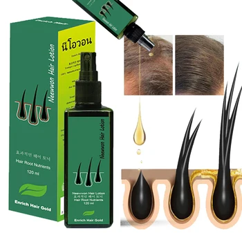  Neewwon Rast Vlasov Lotion Originálny Sprej Proti Vypadávaniu Vlasov Produkty Rýchly Rast Zabrániť Vlasy Suché, Poškodené Rednutie Opravy Starostlivosť