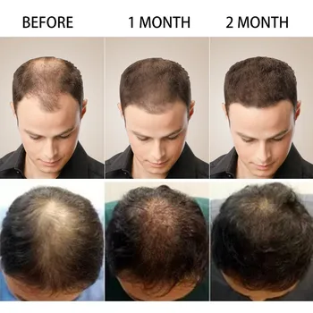  2 Ks Zázvor Rast Vlasov Sprej Sérum Proti Vypadávaniu Vlasov Produktov Krásy Vlasy, Vlasovú Pokožku Rýchlo Rastú Zabrániť Vlasy Suché, Poškodené Opravy Starostlivosť