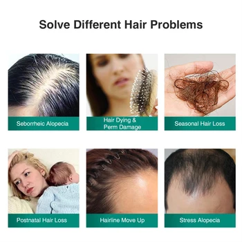  Nový Upgrade Vlasy Repair Esenciálny Olej Prirodzený Rast Vlasov Sérum Pre Suché, Poškodené Vlasy, Opraví Vlasy Folikulu Starostlivosť O Vlasy Zabrániť Vlasy